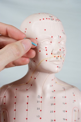find a licensed acupuncturist
