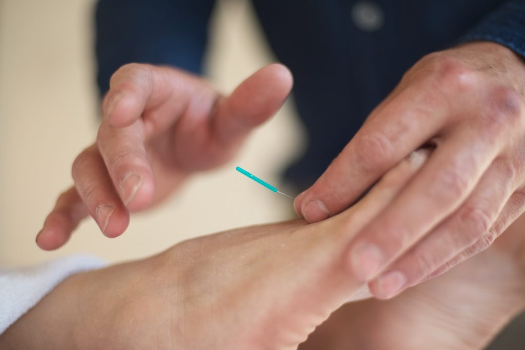 rescue acupuncture 9 1024x683