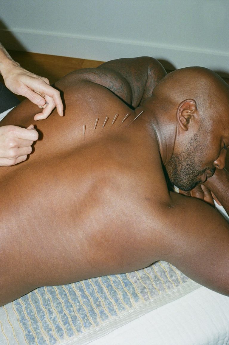 Pointe Acupuncture