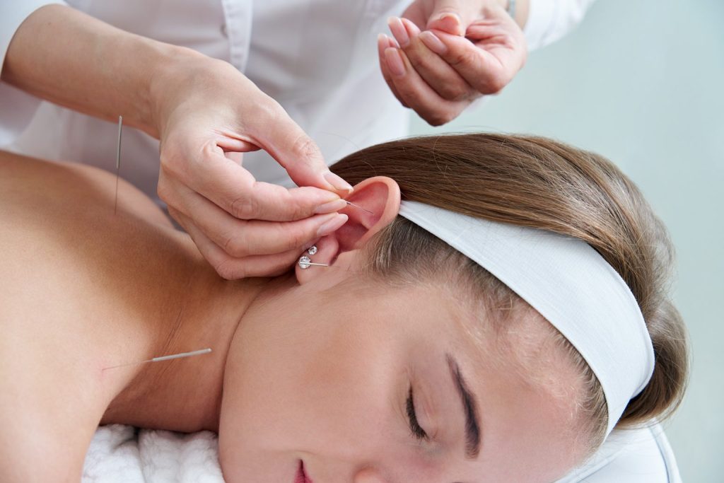 beautiful-woman-relaxing-bed-having-acupuncture-treatment-with-needles-around-her-ear-1536×1025
