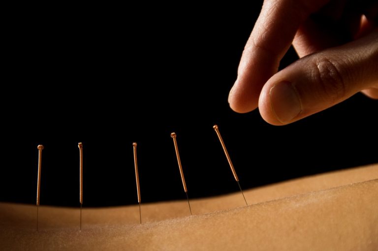 back-pain