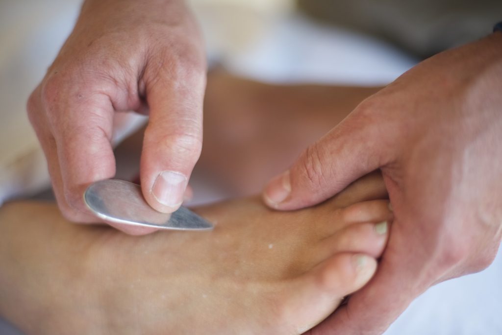 rescue acupuncture 10 1024x684