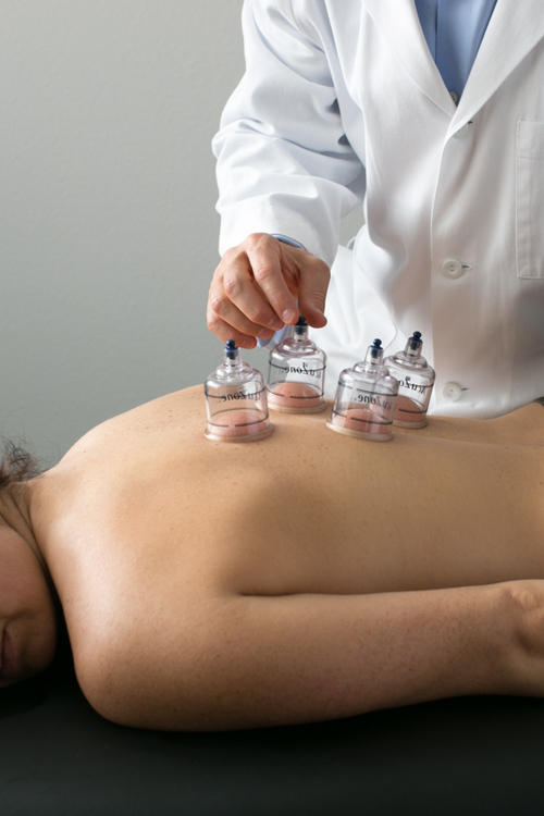 robert cupping